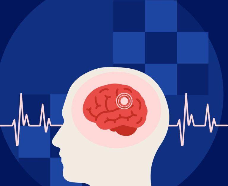 Банер для блогу до статті - як розпізнати інсульт?