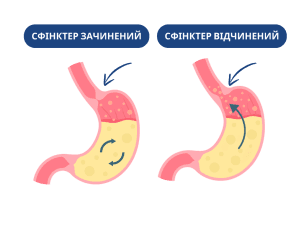 Нижній сфінктер стравоходу (зліва - зачинений, справа - відчинений)